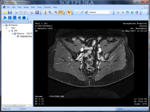MicroDicom download