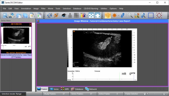Sante DICOM Editor download